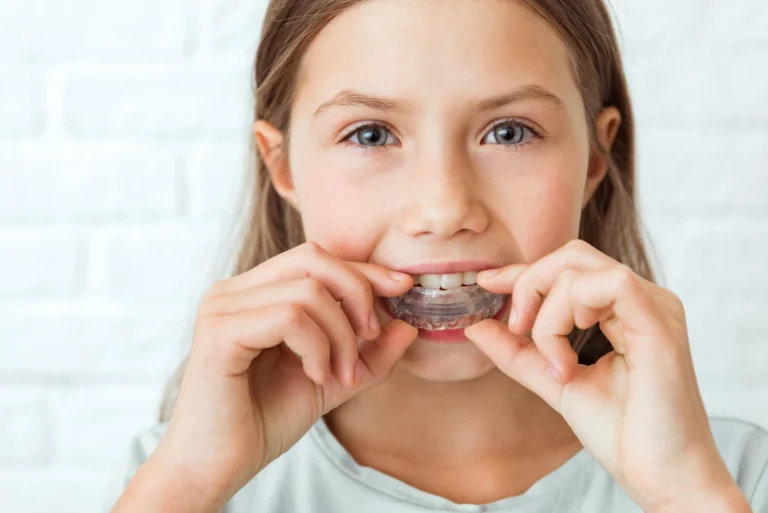 Gestione dei traumi dentali